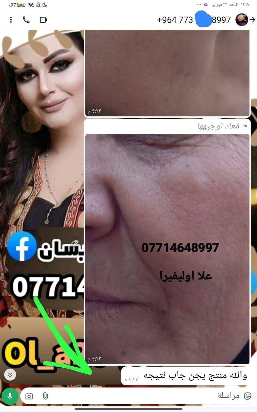 مع بكج العنبر المتكامل ماكو مستحيل 💪 منتجاتي الي اثبتت جدارته 🫶🏻ربي لك الحمد 🤲
عنوانه الثقه وتجاربنا تشهد  🫶 
انتبهو على تجارب كولهن بالارقام الهاتف  افتحو الصوره 
احبكم واحب تجاربكم

نص مكتوب في الصور:
- ***********
- علا اوليفيرا
- +964 773 8997
- معاد توجيهها
- بنان
- 07714
- OLA
- والله منتج يجن جاب نتيجه
- مراسلة
- علا اوليفيرا فرع ميسان
- *********** *********** علا اوليفيرا
- +964 782 280
- ۳ مرات بلسبوع تخلين فقط على بصله الشعر ولازم ينغسل ورا ما يبقى على شعر مده ٣ ساعات او ٤
- ١١:٣٥ م
- يصيرن 35 ١١:٣٦ م
- اكلج حبي وقبل سنه اختي اخدت منج زيت مدري شنو للشعر شنو للعسم مال الجسم
- ١١:٣٧ م
- وهسه ما عدهه شعر جسمهه صار خفيف كلش
- عندج منه
- 077
- OL
- ووجعي يدعيلج عل هل خلطه الحلوه والله اكعد من النوم منوره
- ١١:٣٩ م
- عود بعدني ما حافه
- علا اوليفيرا فرع ميسان ***********
- +964 776 2549 *********** هاي قبل تحضري للجمال *********** BAN يرا 077
- +964 776 2591 الله يعافيج بعد روحي ٥:٢٨ م طمنيني اخذتي صوره قبل وبعد الاستخدام ٥:٢٨ م هاا وصورت الج لان جنت ما صدكه ٥:٢٩ م علا اوليفيرا شوفي الكلوب عد بعضهاا ٥:٣٠ م *********** ٥:٣٠ م شوفي شلون جان مدمر الحنج ٥:٣١ م *********** ٥:٣٢ م صلاوات على محمد شوفت عينج ٥:٣٢ م مراسلة
- +964 786 7121 *********** علا اوليفيرا B A N كيمرر علا اوليفيرا والمسمن بديت بي قبل جم يومم خلاني شكد اكل اهلا وسهلا يقلبي ماشاءالله