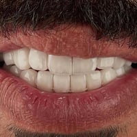 عيادة أسنان • تقويم أسنان • طويريج