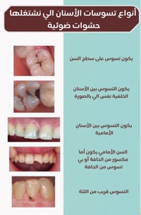 نبدأ باستقبالكم لإجراء علاجات الأسنان مجانًا ✨ وتحت إشراف كادر تدريسي ...