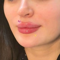 عيادة ايفا • مدينة الصدر • فلر شفايف