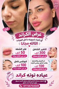 توته كراند • فلر • عرض كل اثنين