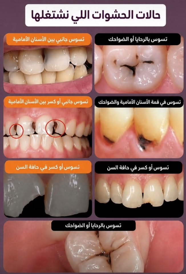 علاج مجاني • عيادات جامعة الإسراء • كرادة ساحة الأندلس