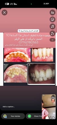 عيادة أسنان • العلاج مجاني • الكرادة شارع ٥٢
