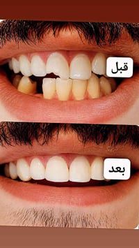 مشيرفة • صيدلية محمود • حجز