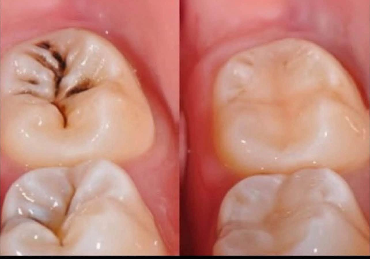 علاج اسنان مجانا تحت اشراف دكاترة مختصين
للاستفسار واتساب ***********
كربلاء الموظفين قرب مستشفى الولادة

نص مكتوب في الصور:
- مجانااﺍ