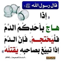 حجامة طبية • مركز الشفاء • الرمادي السجاريه