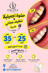 أورلينا • ابتسامة هوليود • الأمين الثانية