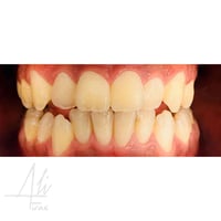 علاج مجاني • أطباء اختصاص • حشوات تجميلية