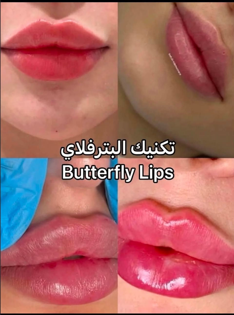 عيادة الدكتور مصطفى خميس الجنابي
اخصائي الأمراض الجلدية والحساسية والتناسلية والتجميل والليزر 
الفلر -البوتوكس-ميزوثيرابي -خيوط ذهبية -ازالة الشعر بالليزر 

العنوان/الانبار -الفلوجة -شارع الاستخبارات -مجمع البلسم الطبي- مقابل البوابة الثالثة لمستشفى الفلوجة العام

للحجز/ 
***********.
***********
