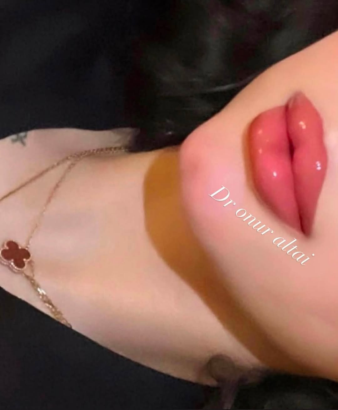 اني دكتوره تجميل هذا شغلي بالفلر والنظاره وهذا رقمي ***********
