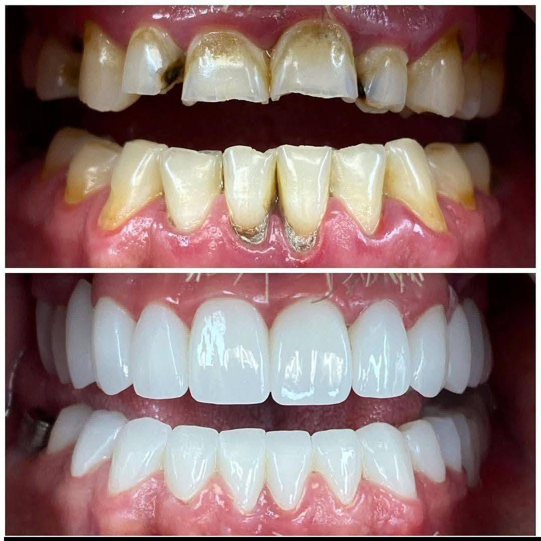 عياده روح لطب وتجميل الاسنان 
د.زهراء صادق 

المحموديه شارع الأطباء مقابيل التربيه مجاور مجمع القمه الطبي عياده روح  للأسنان 
للاستفسار 
***********
