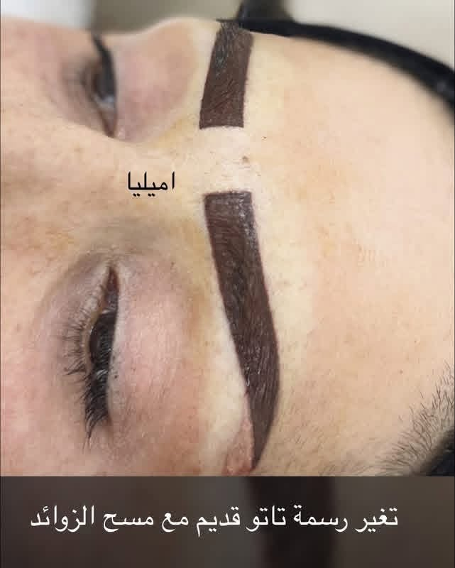 مايكروبلدنك • توريد شفاه • محله 710