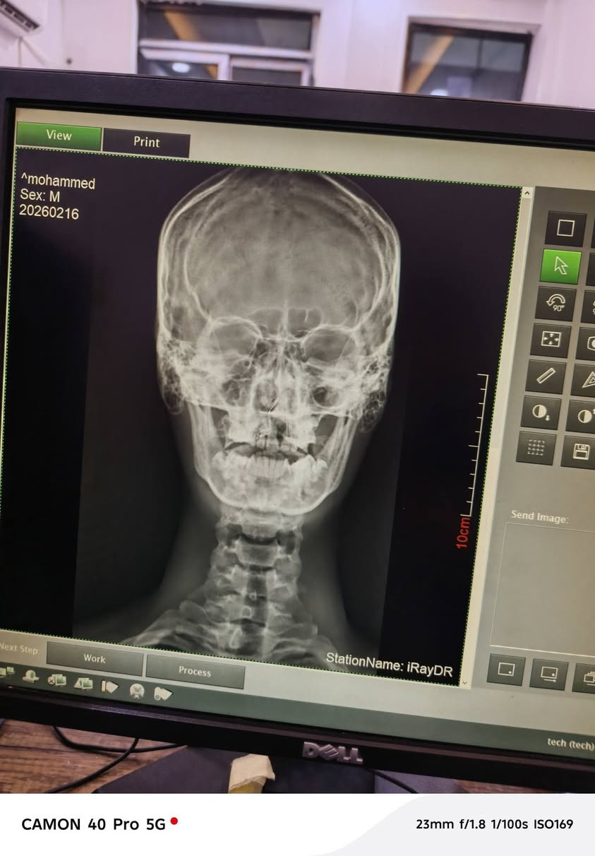 عياده التبارك 
للاشعه العاديه والملونه🩻👨🏻‍⚕️
الموقع الشرقاط
شارع الاطباء مجمع الماس الطبي بين عياده الدكتور عبد الرزاق الترف ولدكتور زين العابدين
📍رقم الهاتف ***********
