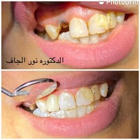 #الهدف لم يكن فقط تحسين المظهر،  #وإنما الحفاظ على أكبر قدر ممكن من بن...