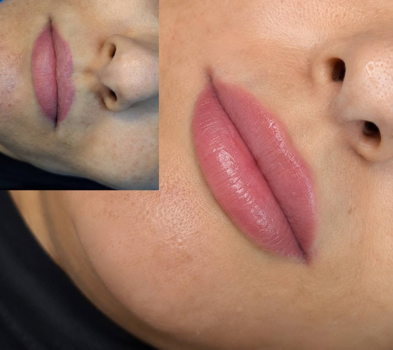 قسم التجميل 💉
السلام عليكم
على بركه اللّٰه
نعلن عن افتتاح قسم التجميل بعياداتنه الكائنه في( حي النداء شارع ٦٠)
العرض الاول للبوتوكس فقط ب85الف بدل 125
لأول5 مراجعين فقط يحصلون على جلسة البوتوكس شد الجبهة ورفع وسحبة الحاجب والتجاعيد حول العين
بوتوكس ابتسامه لثويه فقط ٥٠
بوتوكس تصغير فتحات الانف فقط ٥٠
بوتوكس صرير الاسنان ٥٠ الف فقط
بوتوكس التعرق ١٠٠ فقط
عرض الفلر لل1cc فقط 80الف بدل 100 الف الفحص والاستشاره
مجاناً
التغيير الشامل  للرجال والنساء لكل الوجه وجنات ذقن اصداغ  شفه 500 بدل 900 مع جلسه تنظيف اسنان وبلازما مجاناً
ابره الخلايا الجذعيه لتوقف تساقط الشعر وأنبات الشعر الجديد  75
يوجد أبر نضاره ومحفزات كولاجين وميزوات تفتيح وازاله
التصبغات
عليهن عروض حلوه لفتره محدوده
علما جميع المواد امنه
ومفحوصه ومسجله بوزاره الصحه
للأستفسار والحجز على الارقام الاتيه
***********
***********
