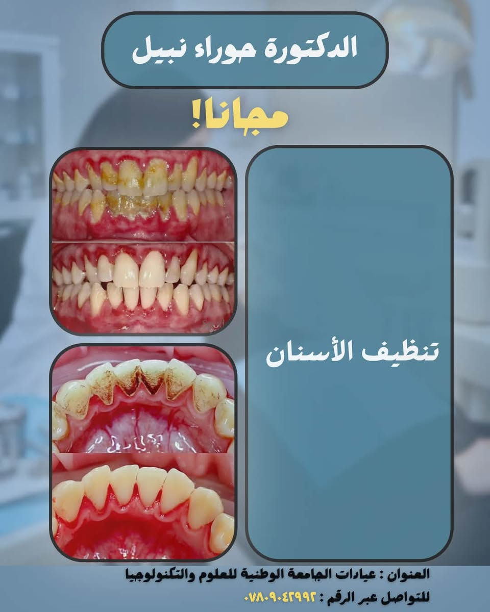 الدكتورة حوراء نبيل 

📌علاج الأسنان مجاناً بإشراف أطباء أسنان إختصاص 

الحالات والخدمات المتوفرة: 
• حشوات ضوئية
• قلع الأسنان والجذور المتبقية
• تعويض الأسنان المفقودة بطقم جزئي متحرك
• تنظيف الأسنان

📍العنوان : الناصرية - التضحية - عيادات الجامعة الوطنية للعلوم والتكنولوجيا

📞 للتواصل عبر الخاص او الرقم : ***********

نص مكتوب في الصور:
- الدكتورة حوراء نبيل مجاناً! BEFORE AFTER حشوات ضوئية العنوان : عيادات الجامعة الوطنية للعلوم والتكنولوجيا للتواصل عبر الرقم : ***********
- الدكتورة حوراء نبيل مجاناً! قلع الأسنان والجذور المتبقية العنوان : عيادات الجامعة الوطنية للعلوم والتكنولوجيا للتواصل عبر الرقم : ***********
- الدكتورة حوراء نبيل مجاناً! تعويض الأسنان المفقودة بطقم جزئي متحرك العنوان : عيادات الجامعة الوطنية للعلوم والتكنولوجيا للتواصل عبر الرقم : ***********
- الدكتورة حوراء نبيل مجانا! تنظيف الأسنان العنوان : عيادات الجامعة الوطنية للعلوم والتكنولوجيا للتواصل عبر الرقم : ***********