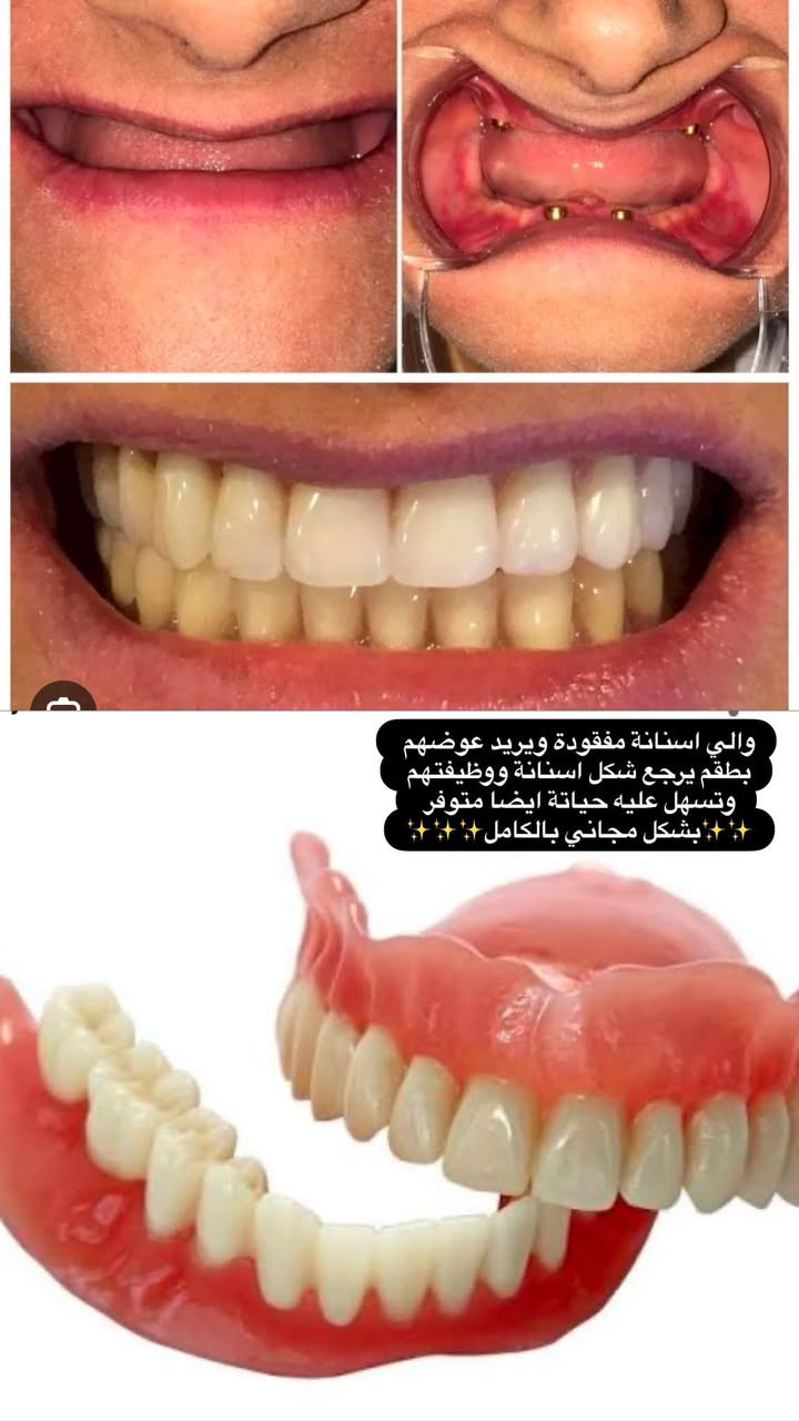 الدورة شارع المصافي • علاج اسنان مجاني • طقم اسنان مجاني