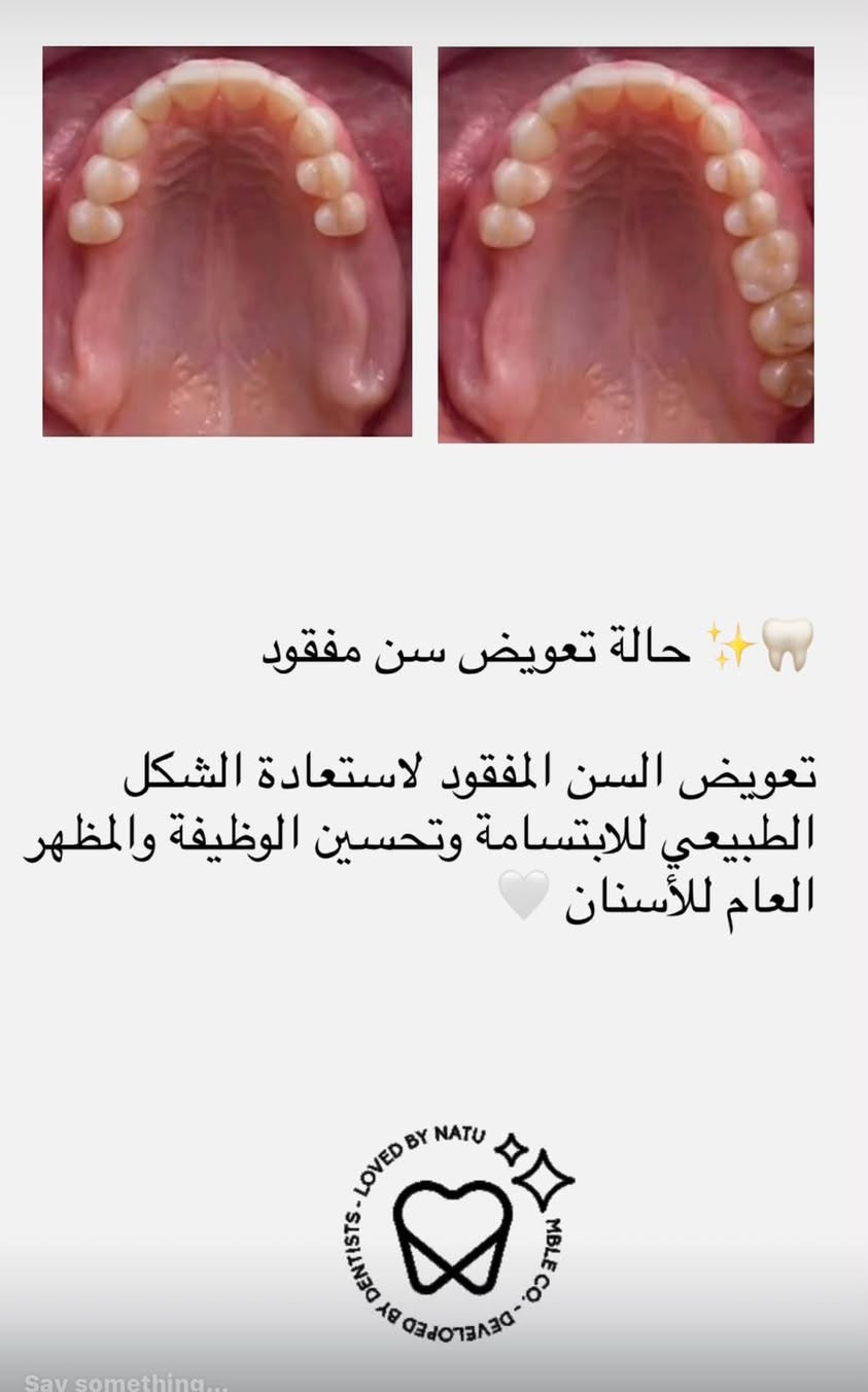 علاج مجاني • تحت إشراف طبي • جامعة اوروك