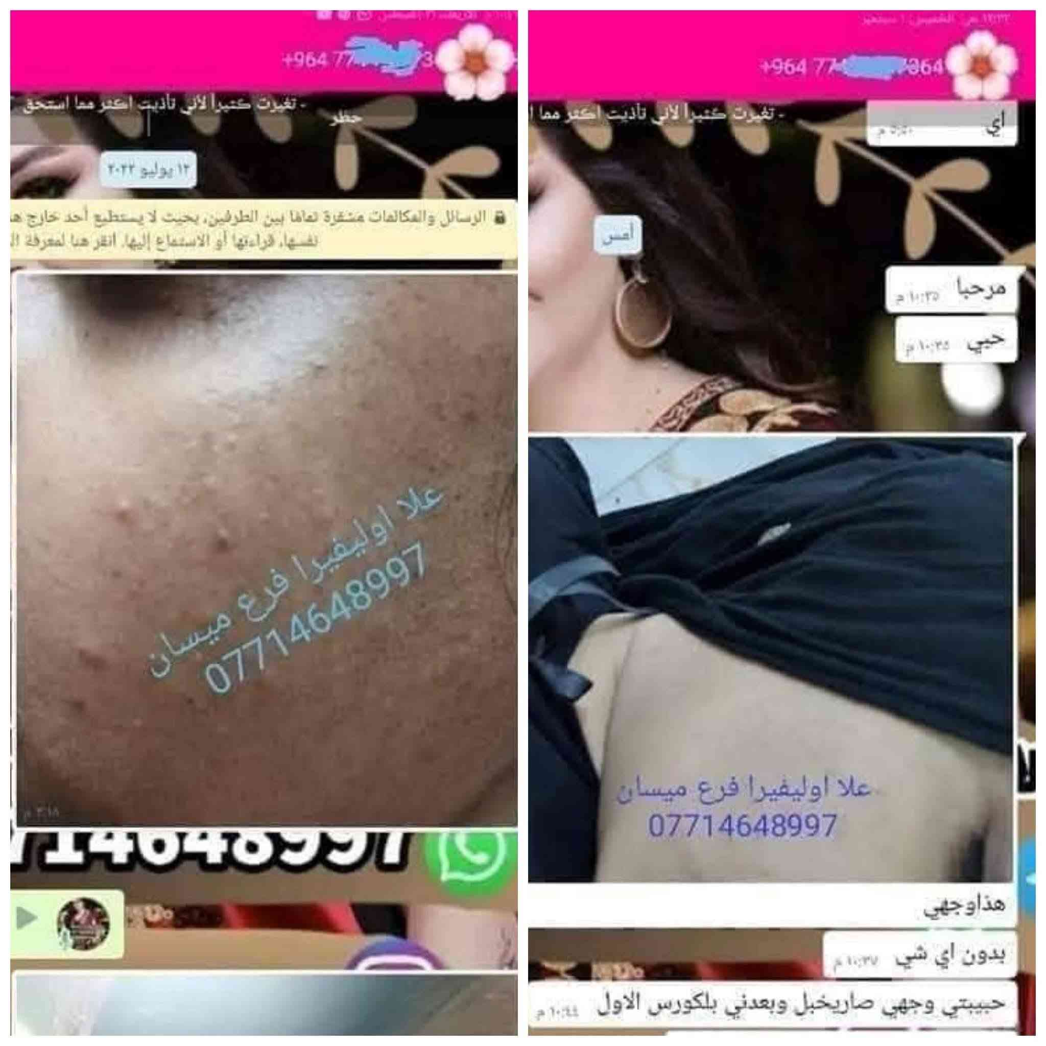 هايرونك • باكشويل • فرع ميسان