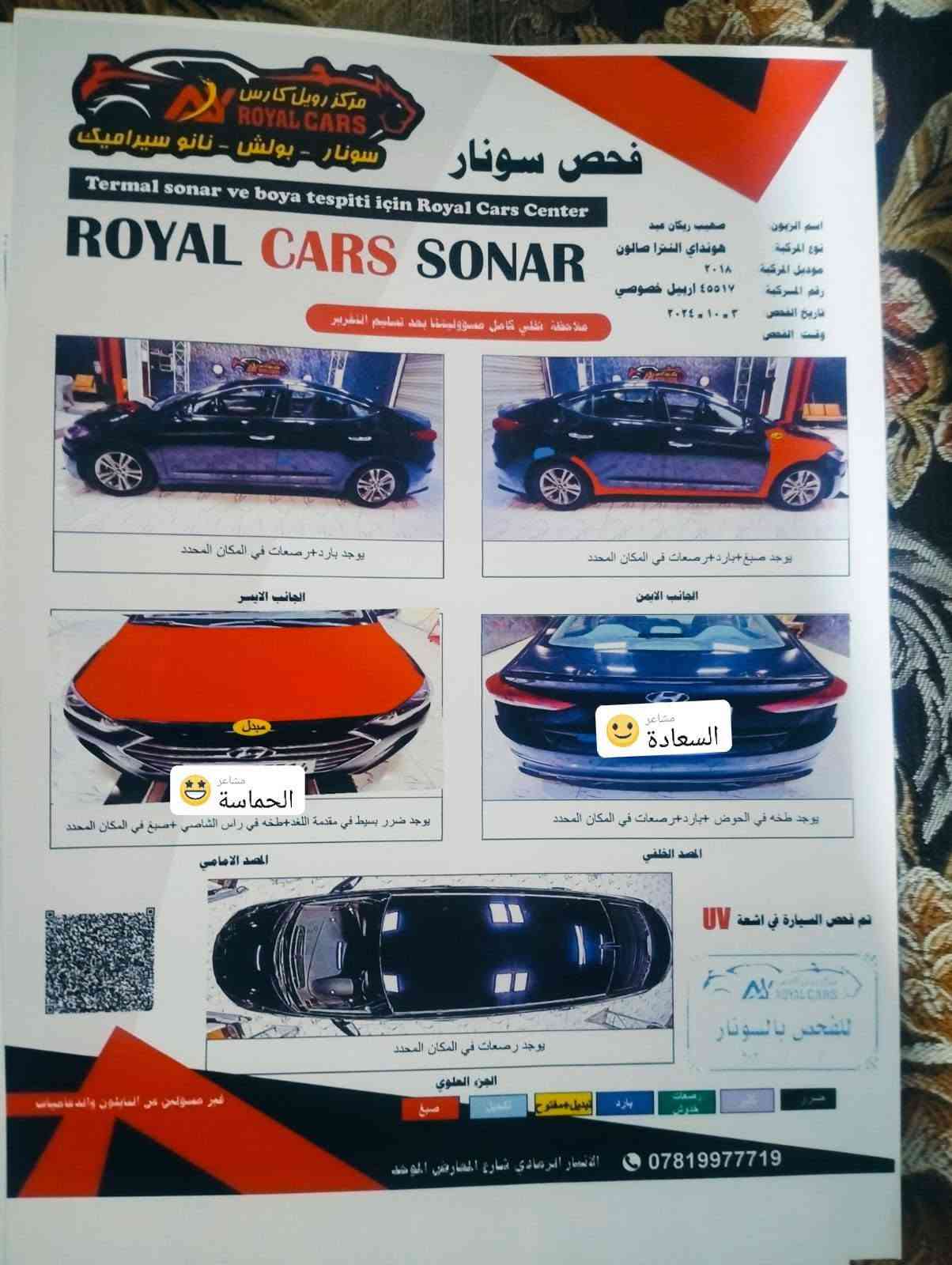سلام عليكم 
مكلف بالنشر 
الانترا موديل ١٨ رقم اربيل بسمنه ثاني اليوم التحويل
جديده ترهم مراوس بكيه عموشه حمل فقط حديث السونار مرفق مع الصور  استفسار اتصل ***********  السعر ١٢٥ بيها مجال

نص مكتوب في الصور:
- مشاعر
- الهدوء
- مشاعر الحزن
- مشاعر الغرام
- مركز رويال كارس ROYAL CARS سونار - بولش - نانو سيراميك Termal sonar ve boya tespiti için Royal Cars Center ROYAL CARS SONAR اسم الزبون صهيب ريكان عبد نوع المركبة هونداي النترا صالون موديل المركبة ۲۰۱۸ رقم المركبة ٤٥٥١٧ اربيل خصوصي تاريخ الفحص ٢٠٢٤٠١٠٠٣ وقت الفحص ملاحظة نخلي كامل مسؤوليتنا بعد تسليم السيارة يوجد بارد + رصعات في المكان المحدد الجانب الايسر يوجد صبغ بارد + رصعات في المكان المحدد الجانب الايمن مبدل مشاعر السعادة يوجد ضرر بسيط في مقدمة الغد + طخه في راس الشاصي + صبغ في المكان المحدد الصدم الامامي مشاعر الحماسة يوجد طخه في الحوض + بارد + رصعات في المكان المحدد الصدم الخلفي تم فحص السيارة في اشعة UV للـفـحص بـالسونار يوجد رصعات في المكان المحدد الجزء العلوي صبغ تعديل تبديل مفتوح بارد رصعات خدوش ضرر غير مسؤولين عن الصابون والدعاسات الارستار الرمادي شارع المعارض في الموصل ***********
