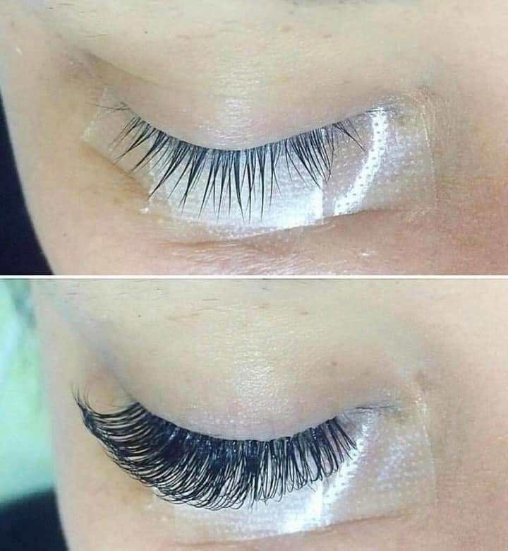 صباح الخير والعافية
*********** وتساب
صالون الفرشات

نص مكتوب في الصور:
- نتيجه الليزر بعد ثالث جلسه
- صالون الفراشات
- ***********
