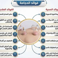 حجامة علاجية • عيادة الساقي • قضاء النصر