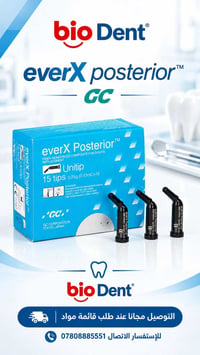 everX Posterior • كمبوزيت ألياف • بديل عاج