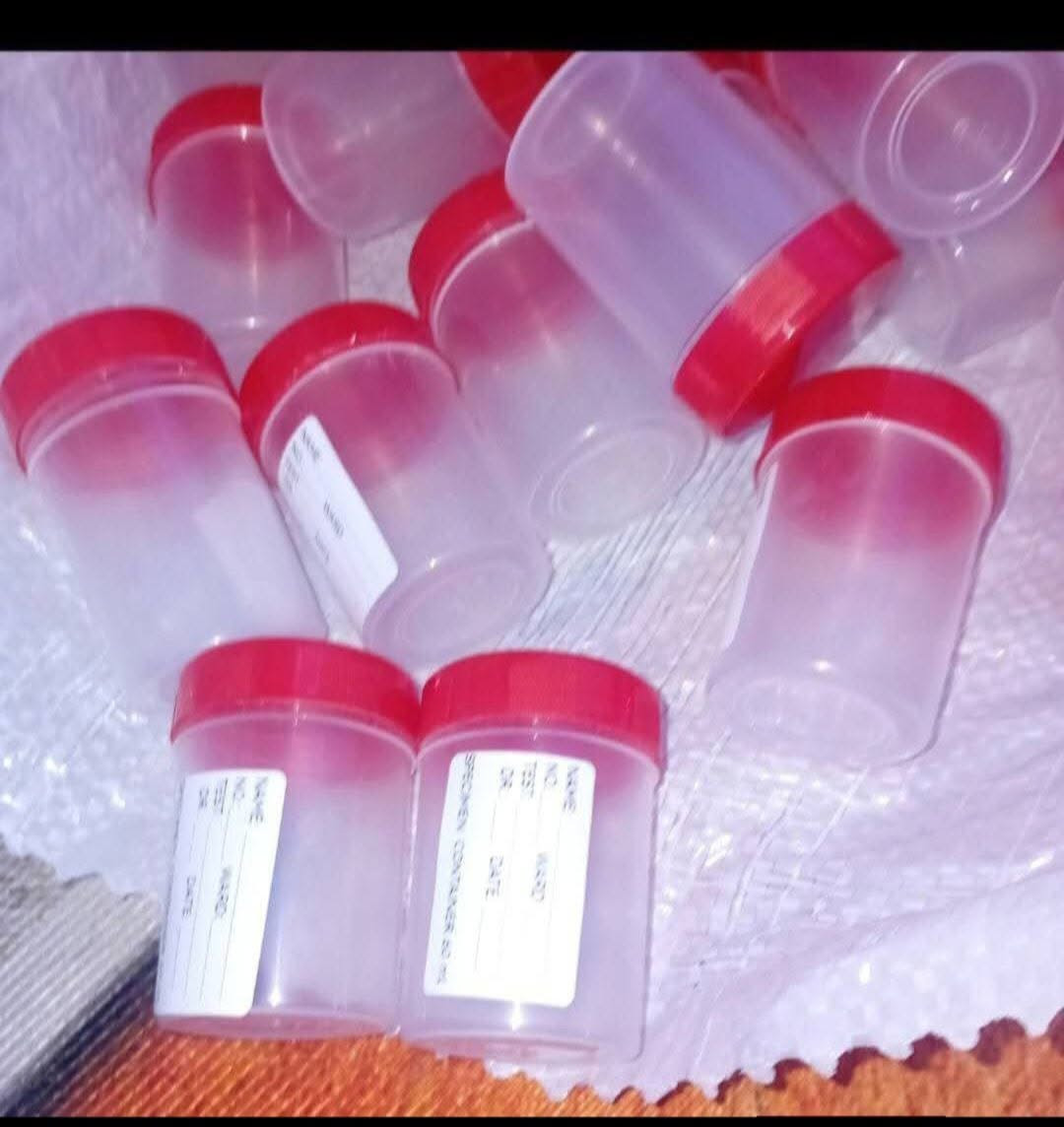 قالب علبة تحاليل ابو 8 وزن 6 غم
قالب قبق علبة تحاليل ابو 8 وزن 2غم
بغداد
التواصل واتساب او اتصال ***********
