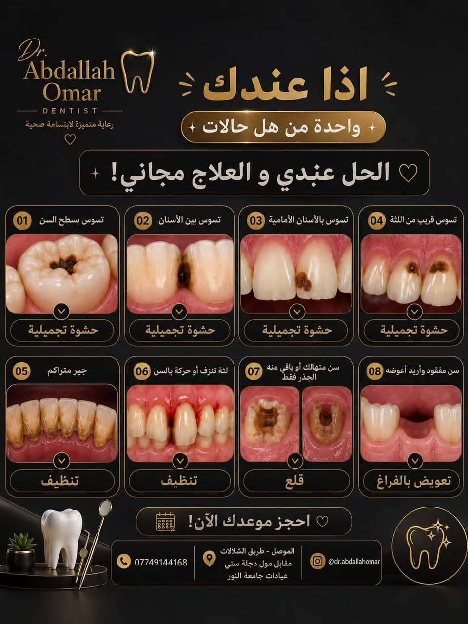 الموصل • علاج مجاني • حشوات تجميلية