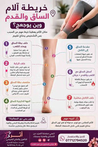 آلام الساق • جلسات منزلية • نساء بغداد