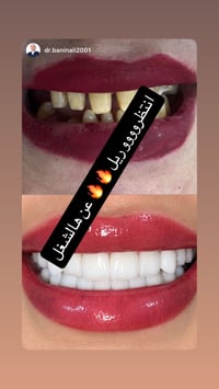 ابتسامة المشاهير • تقسيط • حي العامل