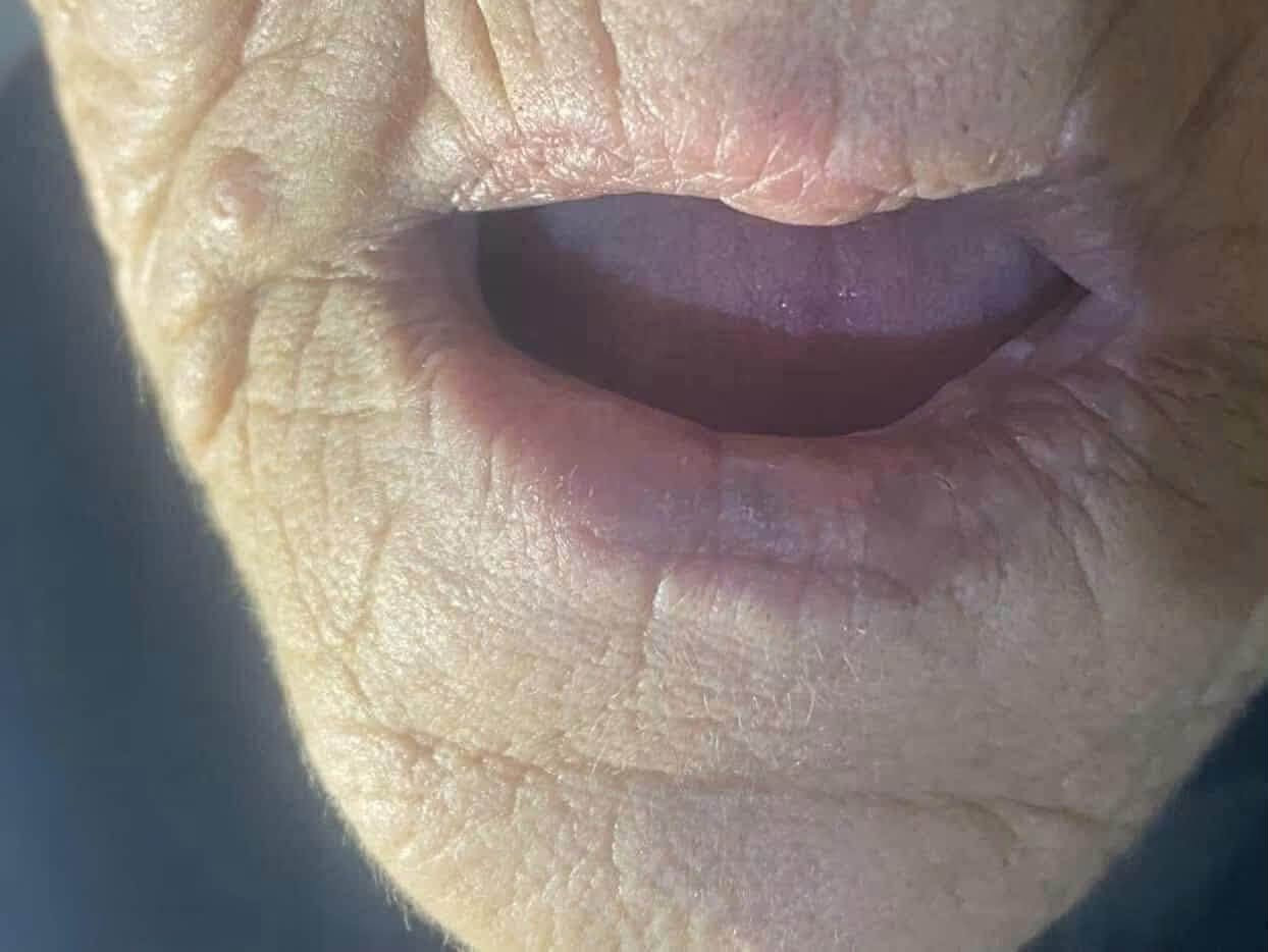 السلام عليكم
للعنده هيج حالات ويريد يعالجهن مجاناً يتفضل خاص 
تحياتي للجميع

نص مكتوب في الصور:
- Oral Answers