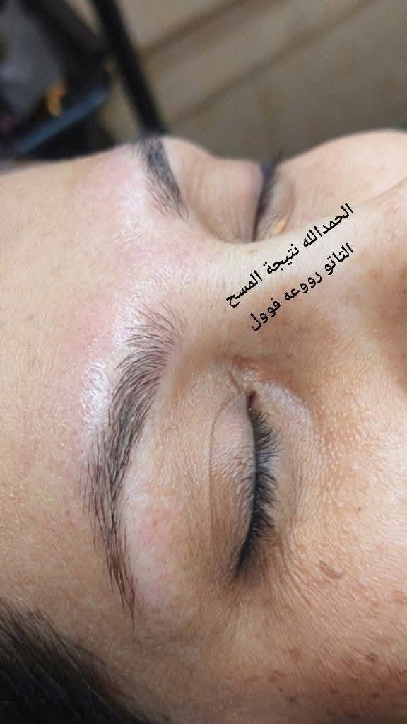 ازلاله مسح بماده حبريه امريكيه اجنن من اول جلسه بدون اي تأثير عل الجلداوحروق يرجع حاجبج طبيعي بشرط 👍
المدربة الكوافيره ام محمد 🧿🧿
صالون ورده بغداد 🌺🌺
والاستفسار على الواتساب 👈 ***********☎️🧿

السماوه حي الحسين 🙏🧿
خلف مطعم بولفارد
على الحجز قبل بيوم👉👉👉📞
ازلاله مسح بماده حبريه امريكيه اجنن من اول جلسه بدون اي تأثير عل الجلداوحروق يرجع حاجبج طبيعي بشرط 👍
ازلاله مسح بماده حبريه امريكيه اجنن من اول جلسه بدون اي تأثير عل الجلداوحروق يرجع حاجبج طبيعي بشرط 👍
