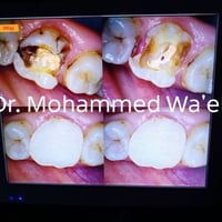 د.محمد وائل سعيد • ماجستير معالجة أسنان • الدورة قرب جامع التوحيد