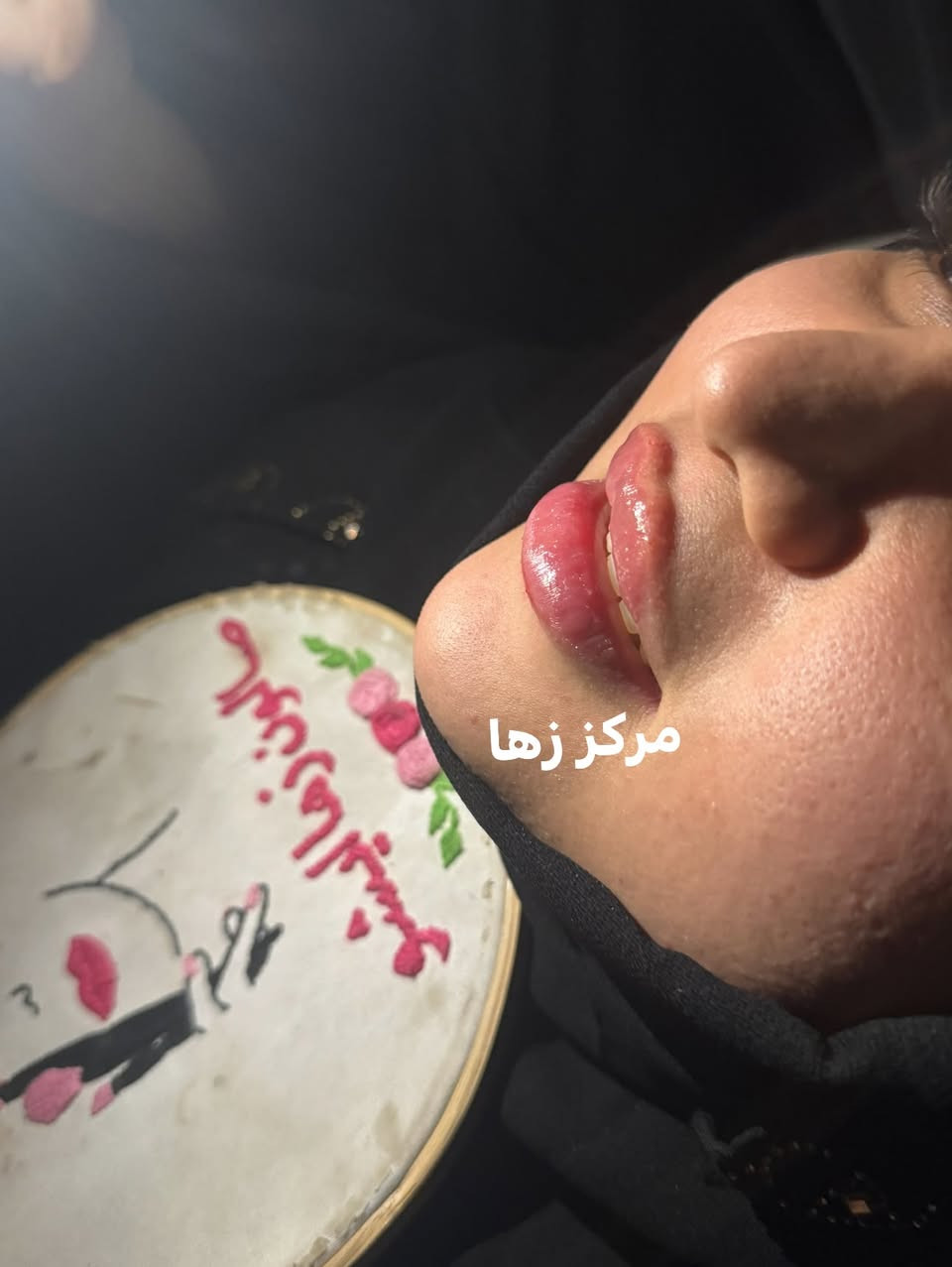 جمال فلر سويسري ولمعته ادمان 😍
مو ماده فروله طريه تجنن 

للاستفسار والحجز واتساب 
***********

ادمونه زهراء

نص مكتوب في الصور:
- مرکز زهرا
- مركز زها