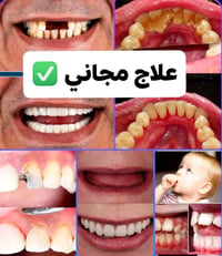 علاج مجاني • تنظيف اسنان • كربلاء