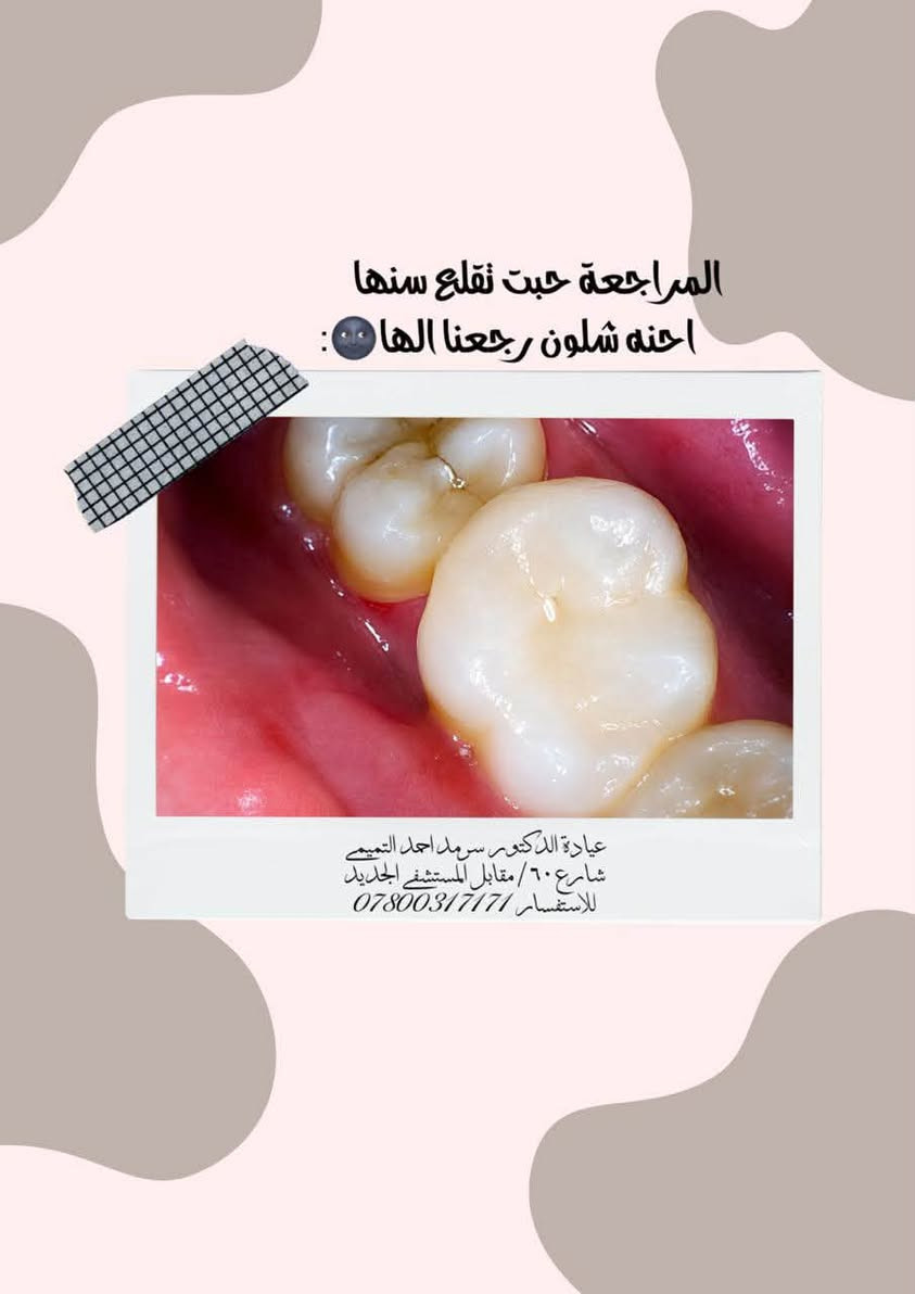✨ ابتسامتك تبدأ ويانه! ✨🦷
تعلن عيادة الدكتور سرمد احمد التميمي عن تقديم أفضل الخدمات العلاجية والتجميلية بأحدث الأجهزة حرصًا منا على راحتكم وصحة أسنانكم.

🔹 خدماتنا تشمل:
• تنظيف وتلميع الأسنان
• حشوات تجميلية وعلاج التسوس
• سحب العصب وعلاج الألم
• قلع الأسنان والجراحة
• تركيبات ثابتة ومتحركة
• تبييض الأسنان
• علاج لثة ونزف اللثة
• متابعة وعلاج أسنان الأطفال
وباسعار مناسبة 💙🦷✨

📍 العنوان: [ مجمع الشفاء شارع 60 مقابل المستشفى الجديدة ]
📞 للحجز والاستفسار: [ ***********]

🌟 لأن ابتسامتكم تهمنا… نهتم بأدق التفاصيل لنمنحكم الراحة والثقة.
زورونا وخلي ابتسامتكم تحچي عنكم
