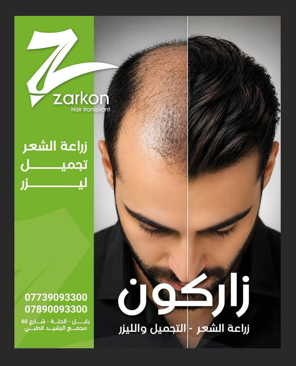 زراعة شعر • أخصائيين إيرانيين • الحلة