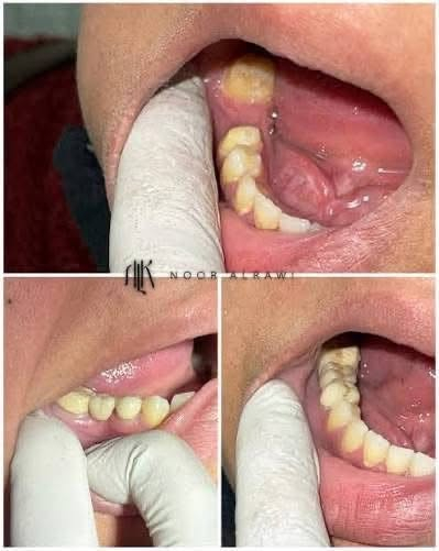 علاج مجاني • طقم متحرك • جامعة الهادي
