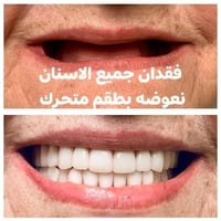 جامعة النور • علاج أسنان • حالات أطفال