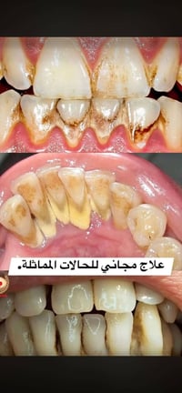 حجز • استفسار • علاج مجاني