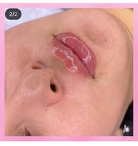 عيادة د. إيلاف • خدمات تجميل • أربعاء-سبت