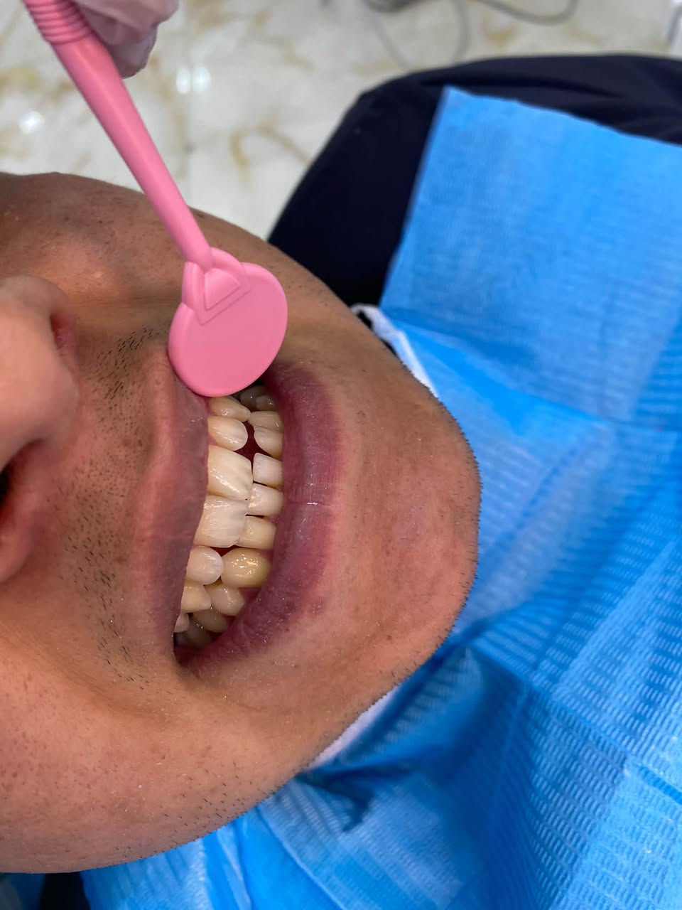السلام عليكم 
 حشوات  تجميليه ، قلع جذور متبقيه وقلع جراحي 
تنظيف الأسنان من التكلسات والتصبغات 
كُل هذا تحت إشراف دكاتره مختصين 
علماً العلاج مجاني 🔥🔥 
العنوان : حي النقيب عيادات جامعه الصفوه 
للحجز ؏ هذا الرقم :***********
