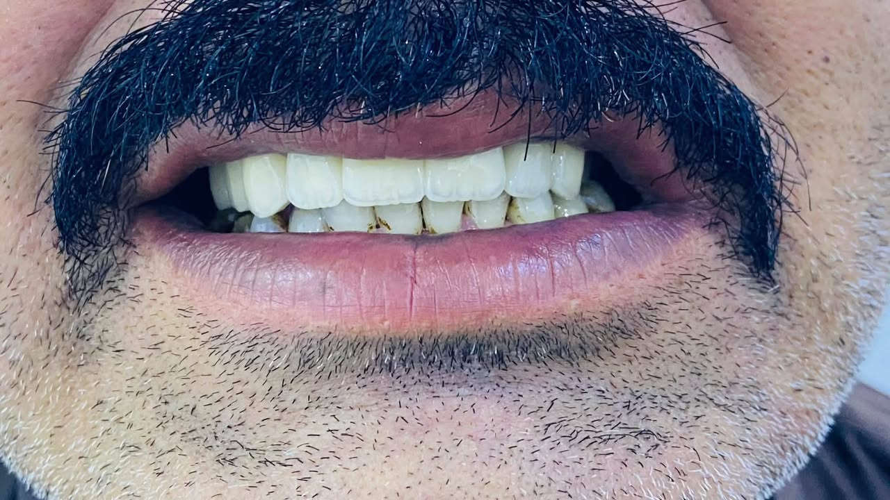 دكتور أمين • حشوات عصب • الشارع القديم شكرا