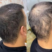 زيت هندي • يقلل التساقط • طول وكثافة