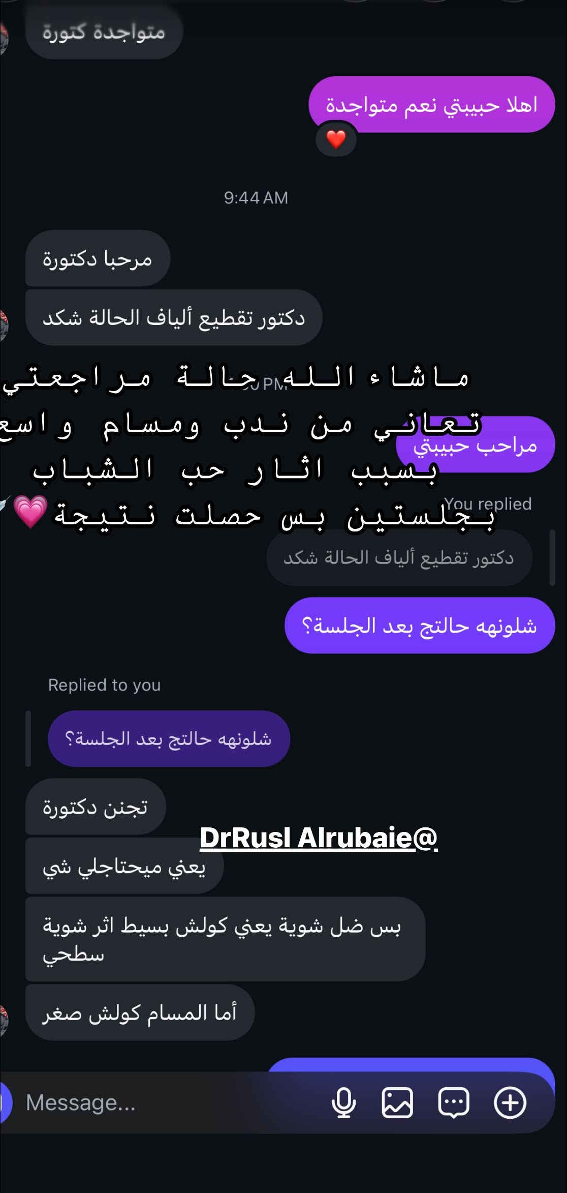 عروض شهر التاسع
مراجعاتي  الحلوات ورأيهم صوت وصوره ماشاءالله الفرق ديشوفو من اول الجلسات لان الاختيار يكون مو عشوائي كل مراجعة نختارلها مكس او ابرة خاصة لحالتها💉💗💗👏 وهو هذا الشغل الصح الي يخليكم تشوفون فرق من الجلسة الاولى 💉🍓

بخصوص العروض مراح تتكرر بعد ابداً لان اقوى عروض سويناهه 

خلال شهر التاسع واقبالكم عليه جداً عالي 💉👏

بخصوص كل المواد الجديدة الي تنزل داخل العياده تكدرون تتابعون صفحة الانستكرام 

https://www.instagram.com/p/DbWWdUhsNAt/?stkn=Z2EwenVjcm5rOXFu

او صفحتنا على الفيسبوك DrRusl Alrubaie

او مراسلتنا واتساب مسج فقط ***********

نص مكتوب في الصور:
- نتائج استمرار المراجعة بحقن ابر النضاره شهريا 0 ماشاء الله تلمع 🤭 ✨✨ وهذا السر الي يخليكم تشوفون فرق لان اختيار الابره يكون حسب الحالة ✨ @DrRusl_Alrubaie
- @dr_Ruslalrubaie
- Before @dr_ruslalrubaie After
- متواجدة دكتورة اهلا حبيبتي نعم متواجدة 9:44 AM مرحبا دكتورة دكتور تقطيع ألياف الحالة شكد PM مراحب حبيتي You replied ما شاء الله حالة مراجعتي تعاني من ندب ومسام واسع بسبب اثار حب الشباب بججلستين بس حصلت نتيجة دكتور تقطيع ألياف الحالة شكد شلونها حالتي بعد الجلسة? Replied to you شلونها حالتي بعد الجلسة? تجنن دكتورة DrRusl Alrubaie@ يعني ميحتاجلي شي بس ضل شوية يعني كولش بسيط اثر شوية سطحي أما المسام كولش صغر Message...