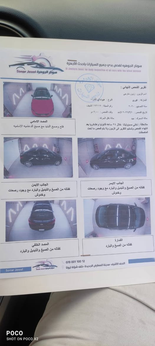 مكلف بل النشر رقم راعيه ***********رق
لنتره مديل 2020 على وضع شركه جديده ماشيه 100 مكينه وكير حداديه تبريد مكفولاتت 
بيهه قطعه وحده بدون دواخل فقط بنيد والباقي كفاله السعر 117 وبيهه مجال *********** مكان النجف النجف, العراق

