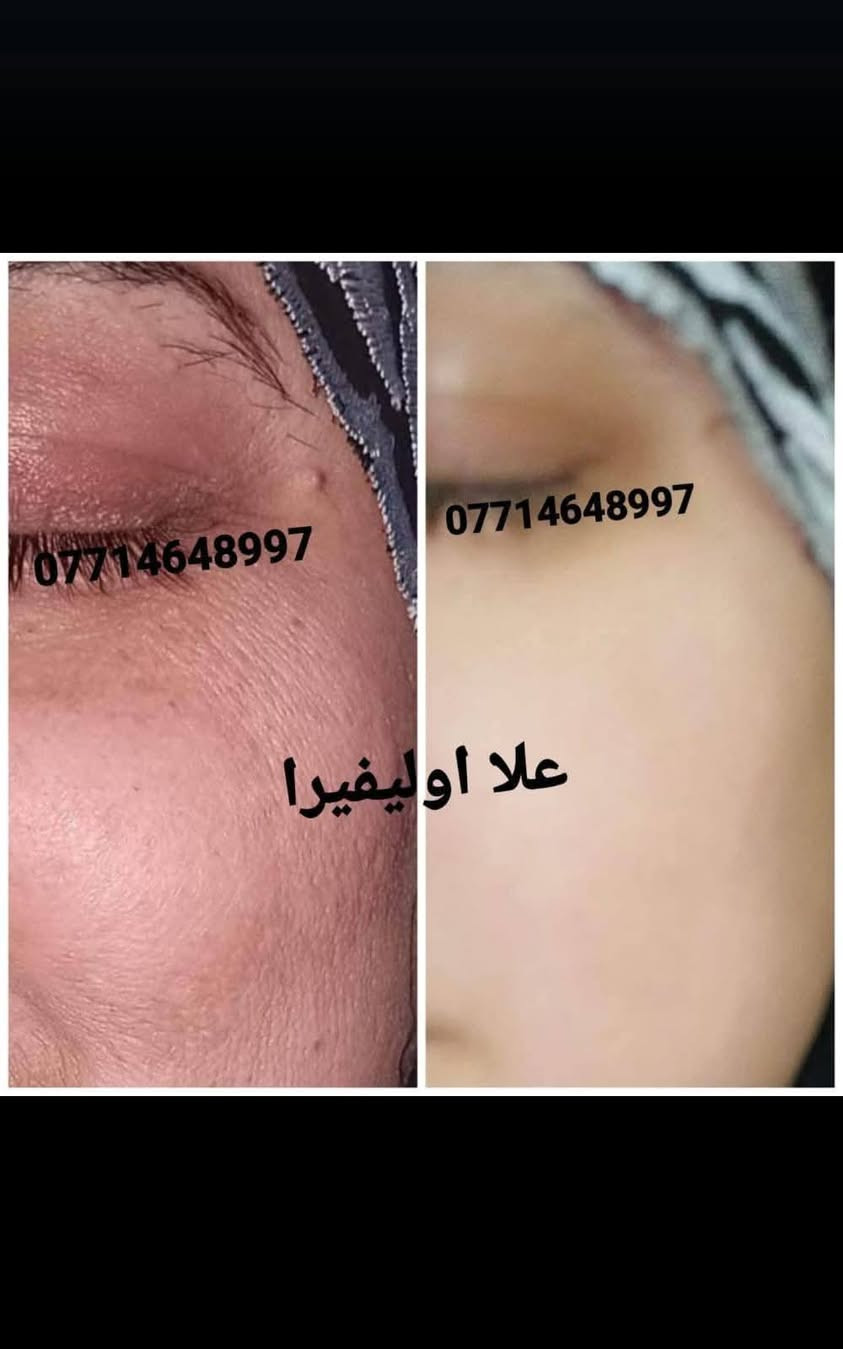 مع بكج العنبر المتكامل ماكو مستحيل 💪 منتجاتي الي اثبتت جدارته 🫶🏻ربي لك الحمد 🤲
عنوانه الثقه وتجاربنا تشهد  🫶 
انتبهو على تجارب كولهن بالارقام الهاتف  افتحو الصوره 
احبكم واحب تجاربكم

نص مكتوب في الصور:
- ***********
- علا اوليفيرا
- +964 773 8997
- معاد توجيهها
- بنان
- 07714
- OLA
- والله منتج يجن جاب نتيجه
- مراسلة
- علا اوليفيرا فرع ميسان
- *********** *********** علا اوليفيرا
- +964 782 280
- ۳ مرات بلسبوع تخلين فقط على بصله الشعر ولازم ينغسل ورا ما يبقى على شعر مده ٣ ساعات او ٤
- ١١:٣٥ م
- يصيرن 35 ١١:٣٦ م
- اكلج حبي وقبل سنه اختي اخدت منج زيت مدري شنو للشعر شنو للعسم مال الجسم
- ١١:٣٧ م
- وهسه ما عدهه شعر جسمهه صار خفيف كلش
- عندج منه
- 077
- OL
- ووجعي يدعيلج عل هل خلطه الحلوه والله اكعد من النوم منوره
- ١١:٣٩ م
- عود بعدني ما حافه
- علا اوليفيرا فرع ميسان ***********
- +964 776 2549 *********** هاي قبل تحضري للجمال *********** BAN يرا 077
- +964 776 2591 الله يعافيج بعد روحي ٥:٢٨ م طمنيني اخذتي صوره قبل وبعد الاستخدام ٥:٢٨ م هاا وصورت الج لان جنت ما صدكه ٥:٢٩ م علا اوليفيرا شوفي الكلوب عد بعضهاا ٥:٣٠ م *********** ٥:٣٠ م شوفي شلون جان مدمر الحنج ٥:٣١ م *********** ٥:٣٢ م صلاوات على محمد شوفت عينج ٥:٣٢ م مراسلة
- +964 786 7121 *********** علا اوليفيرا B A N كيمرر علا اوليفيرا والمسمن بديت بي قبل جم يومم خلاني شكد اكل اهلا وسهلا يقلبي ماشاءالله