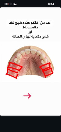 علاج اسنان مجاني • قلع اسنان وجذور • تعويضات بسيطة