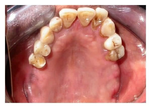 بعيادات جامعة كلكامش 🦷
⭕️ نشتغل طقم جزئي متحرك
❗️العلاج تحت إشراف اطباء اختصاص 
📍العنوان : الدورة / ابو دشير / جامعة كلكامش
التواجد : السبت - الاحد - الاثنين
🕙وقت العيادة: 10 
 
📞 واتساب :
 ***********
